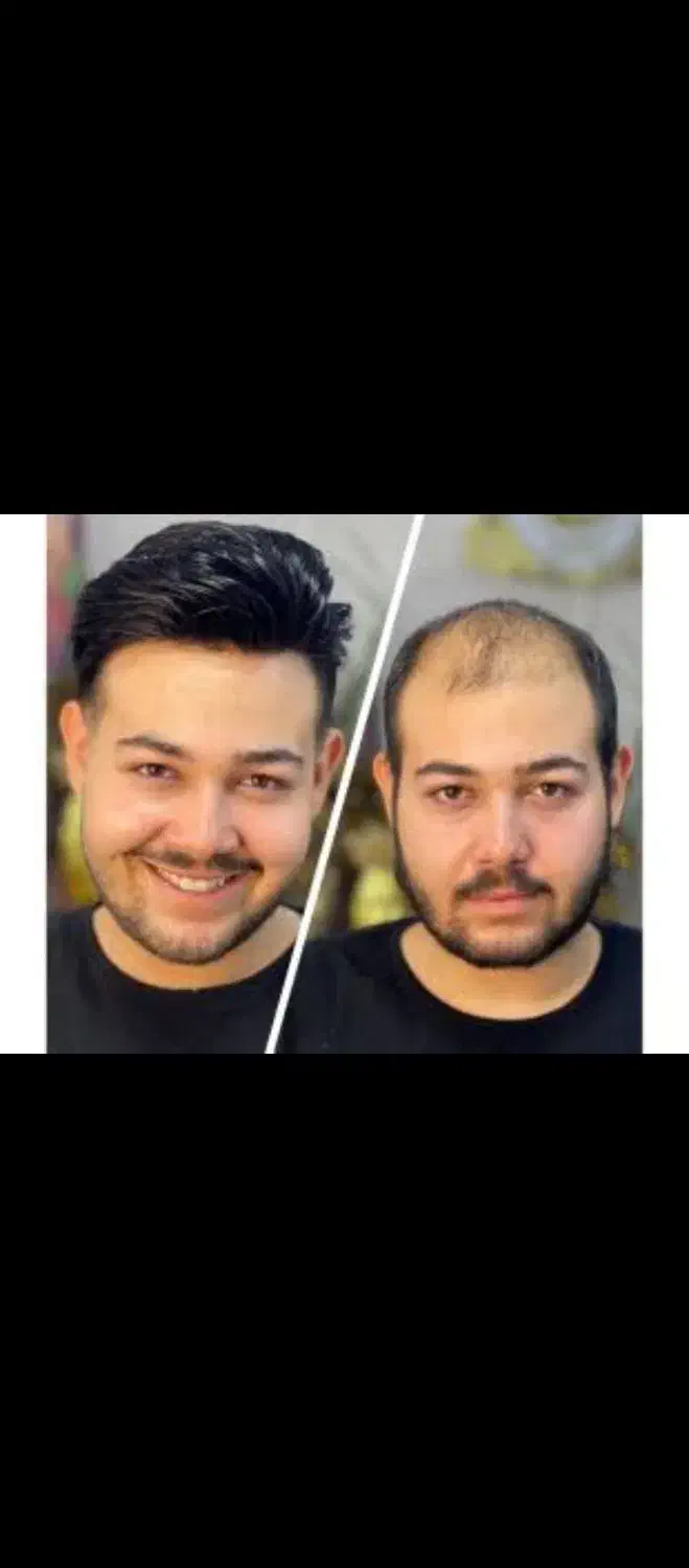 مرکز جوانی مو .خدمات داماد و پاکسازی و تراپی|خدمات آرایشگری و زیبایی|فردیس, فردیس|دیوار