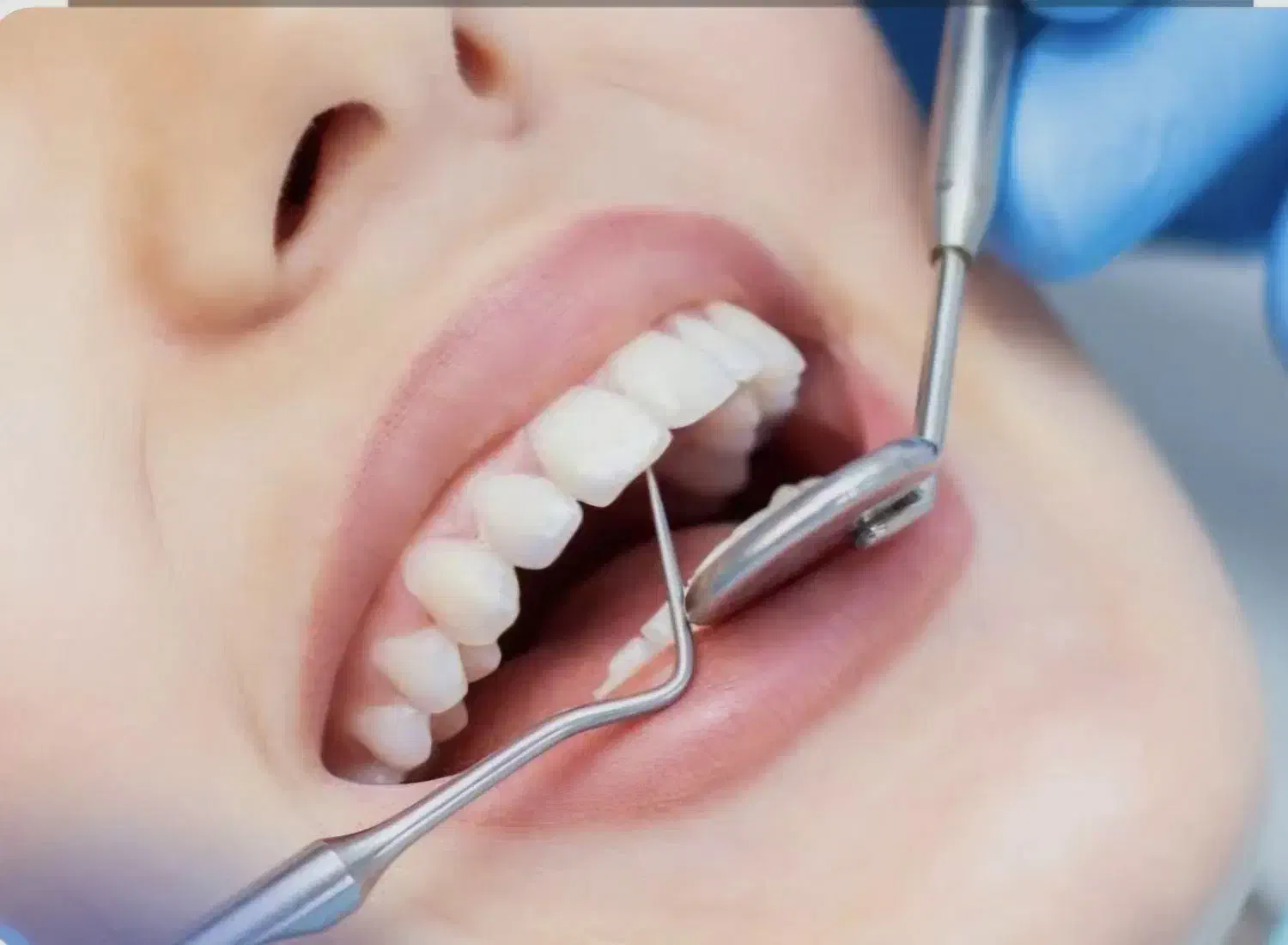 دستیار دندانپزشکی|استخدام درمانی، زیبایی، بهداشتی|اهواز, گلستان|دیوار