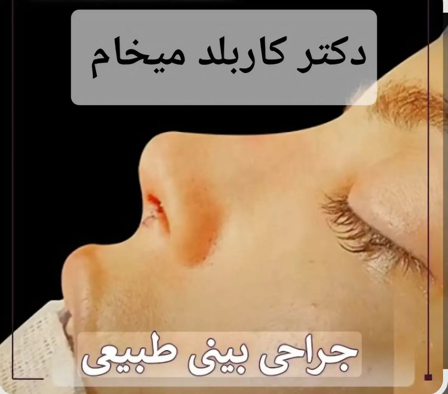 دکتر برای عمل بینی میخام|فعالیت داوطلبانه تحقیقاتی|نیشابور, دارایی|دیوار