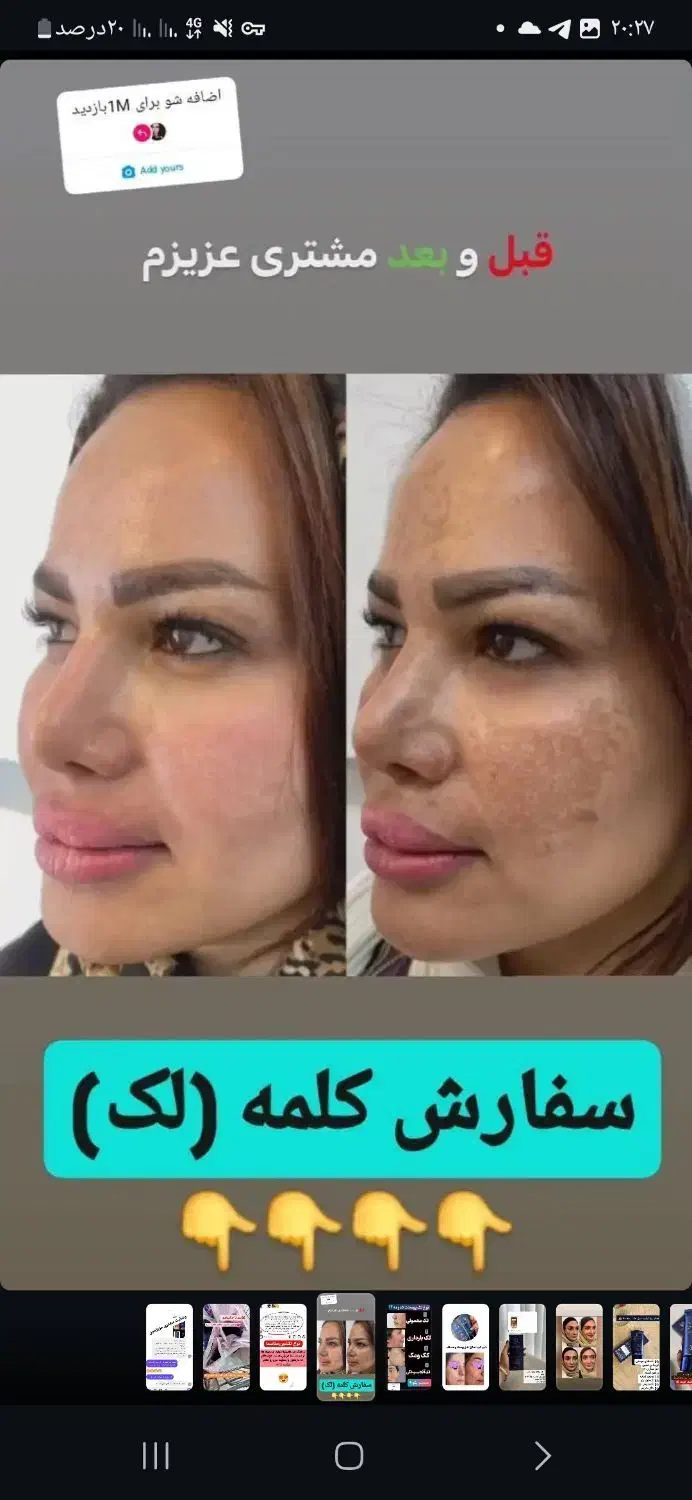 کرم ضدلک لاکچری کوین اصل نمایندگی کوثر|آرایشی، بهداشتی، درمانی|کوثر, |دیوار