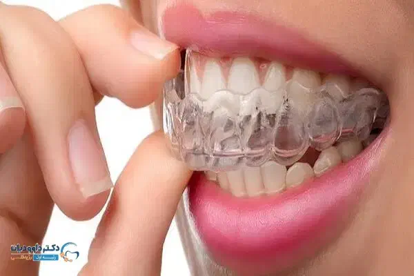 دندان مصنوعی و نایت گارد|آرایشی، بهداشتی، درمانی|اندیشه, اندیشه فاز ۳|دیوار