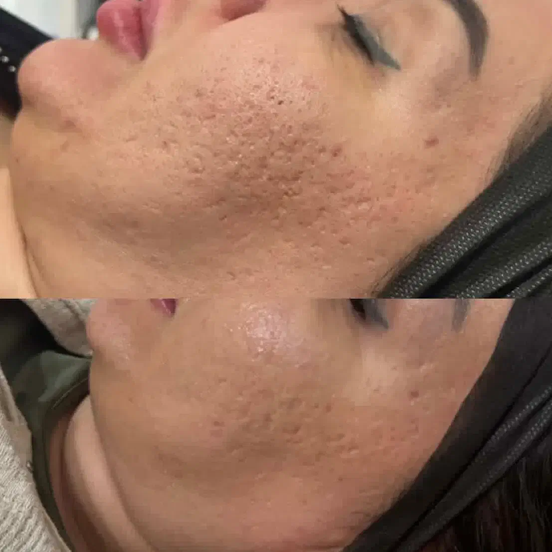 مدل پاکسازی صورت و فیشیال فوری فقط هزینه مواد|خدمات آرایشگری و زیبایی|اهواز, پردیس دو|دیوار