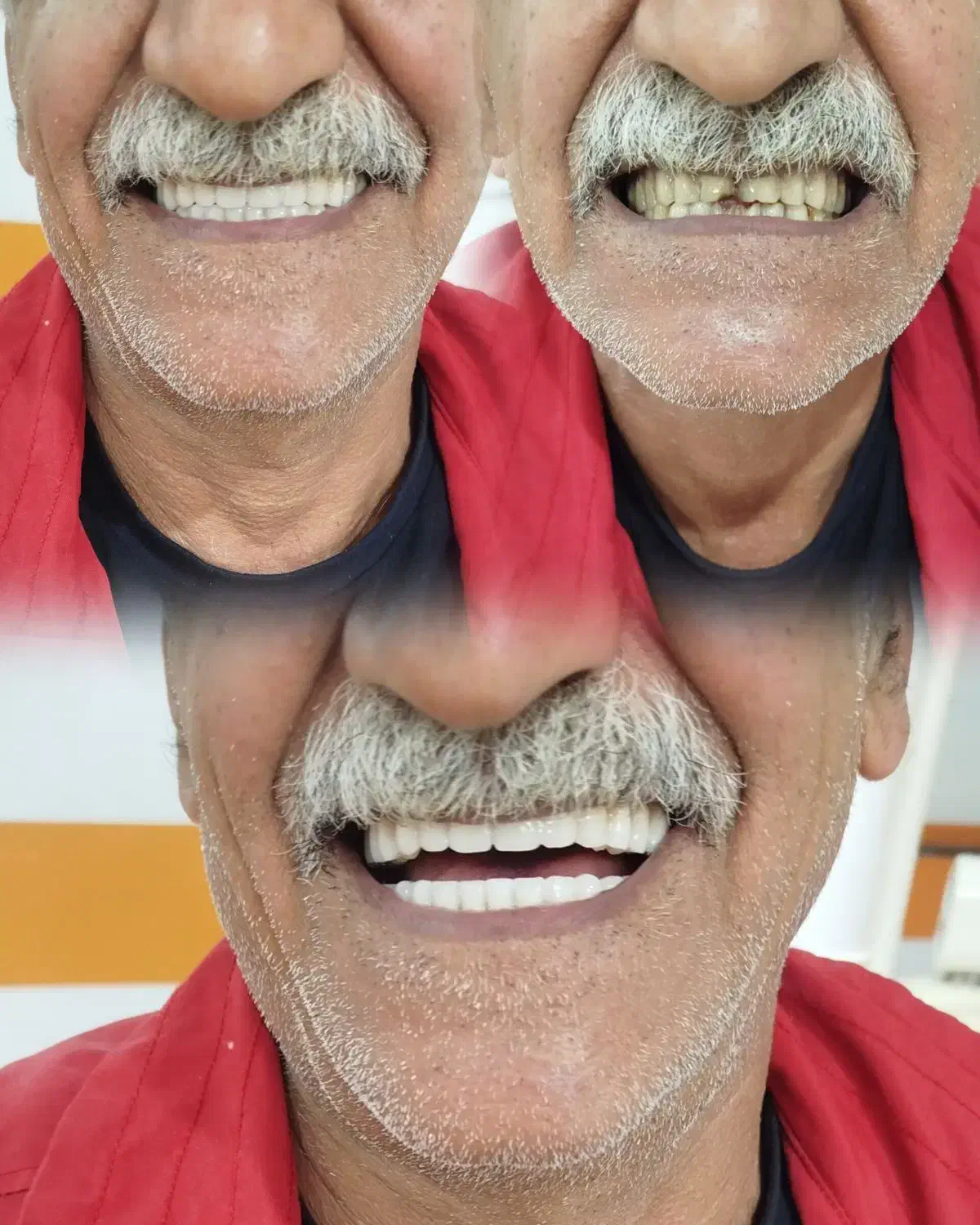 جشنواره دندان مصنوعی خارجی ژله ای با بیمه وضمانت|خدمات آرایشگری و زیبایی|کرج, مصباح|دیوار