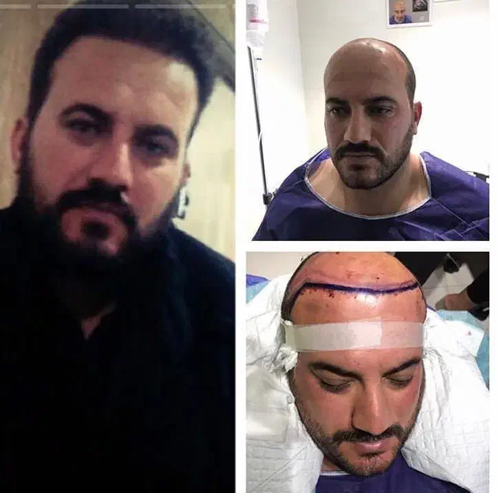 جشنواره کاشت تخصصی موفقط 8/900با ضمانت|خدمات آرایشگری و زیبایی|تهران, پاسداران|دیوار