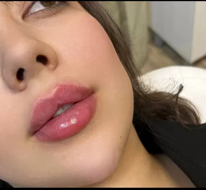 پی آر پی پوست مو و زانو پلاسمای خون PRP|خدمات آرایشگری و زیبایی|قزوین, |دیوار