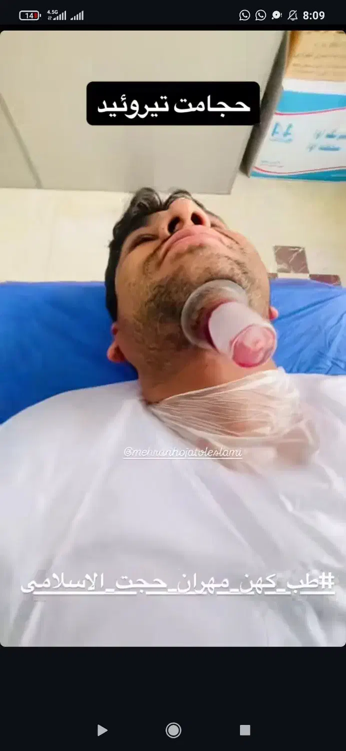 حجامت ، طب سوزنی ، امبدینگ ، بادکش درمانی|خدمات آرایشگری و زیبایی|اندیشه, اندیشه فاز ۳|دیوار