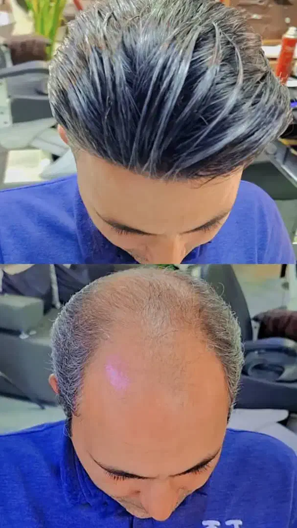 سالن vip پروتز مو کوروش سیناپور|خدمات آرایشگری و زیبایی|شیراز, قلعه شاهزاده بیگم|دیوار