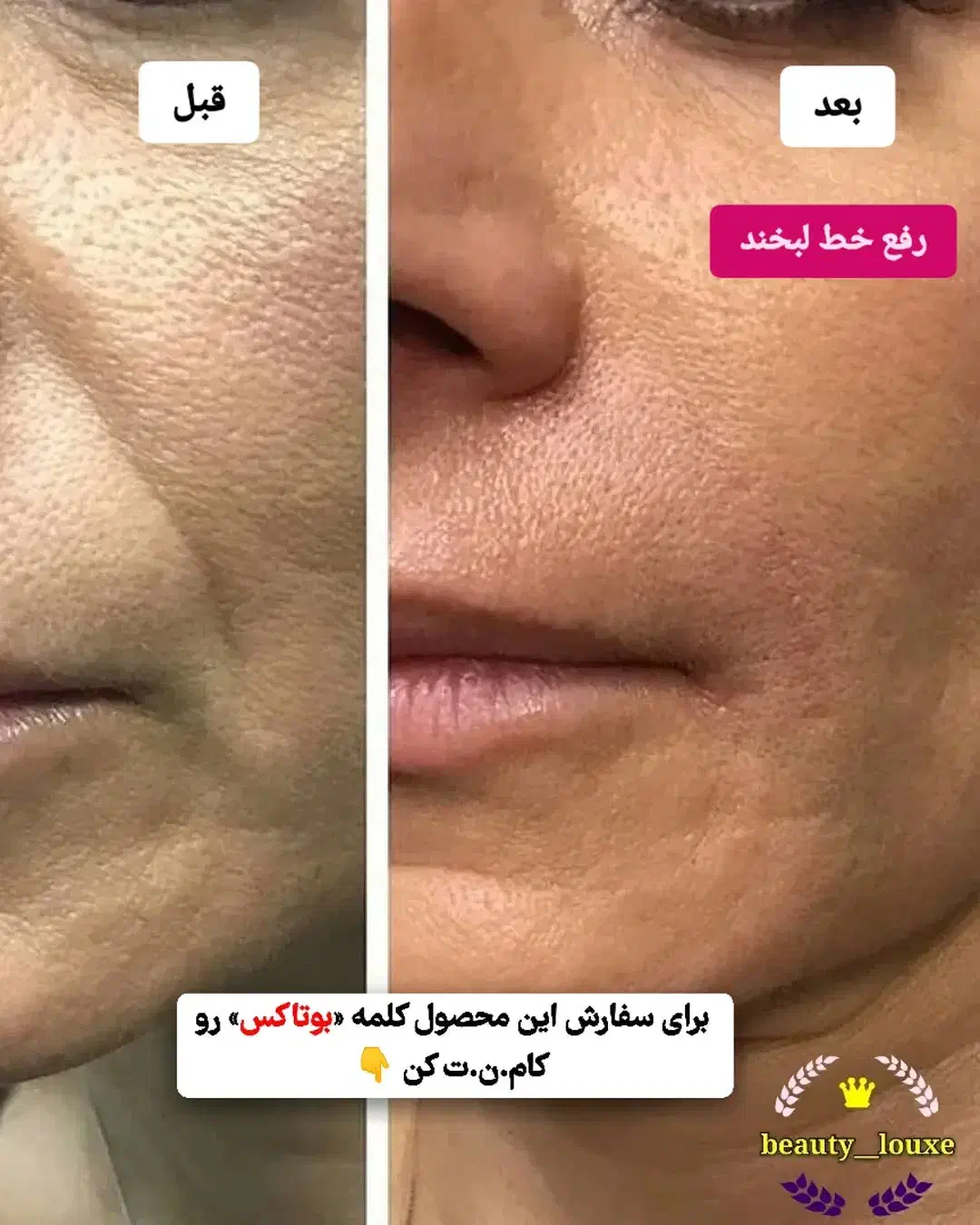 کرم لیفتینگ گاتیو|آرایشی، بهداشتی، درمانی|کرج, شهرک رضوانیه|دیوار