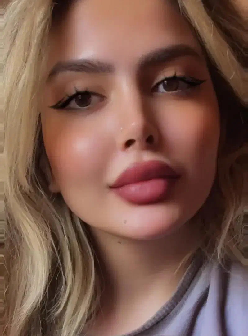 تزریق ژل،بوتاکس درمکانی مستقل بارعایت اصول بهداشتی|خدمات آرایشگری و زیبایی|زاهدان, |دیوار