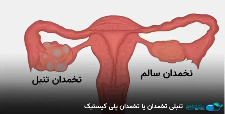 درمان تضمینی وقطعی مشکلات رحم|آرایشی، بهداشتی، درمانی|قم, نیروگاه|دیوار