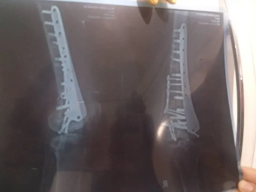 نیازفوری به ۱۰ ملیون پول دارم|فعالیت داوطلبانه تحقیقاتی|تبریز, |دیوار