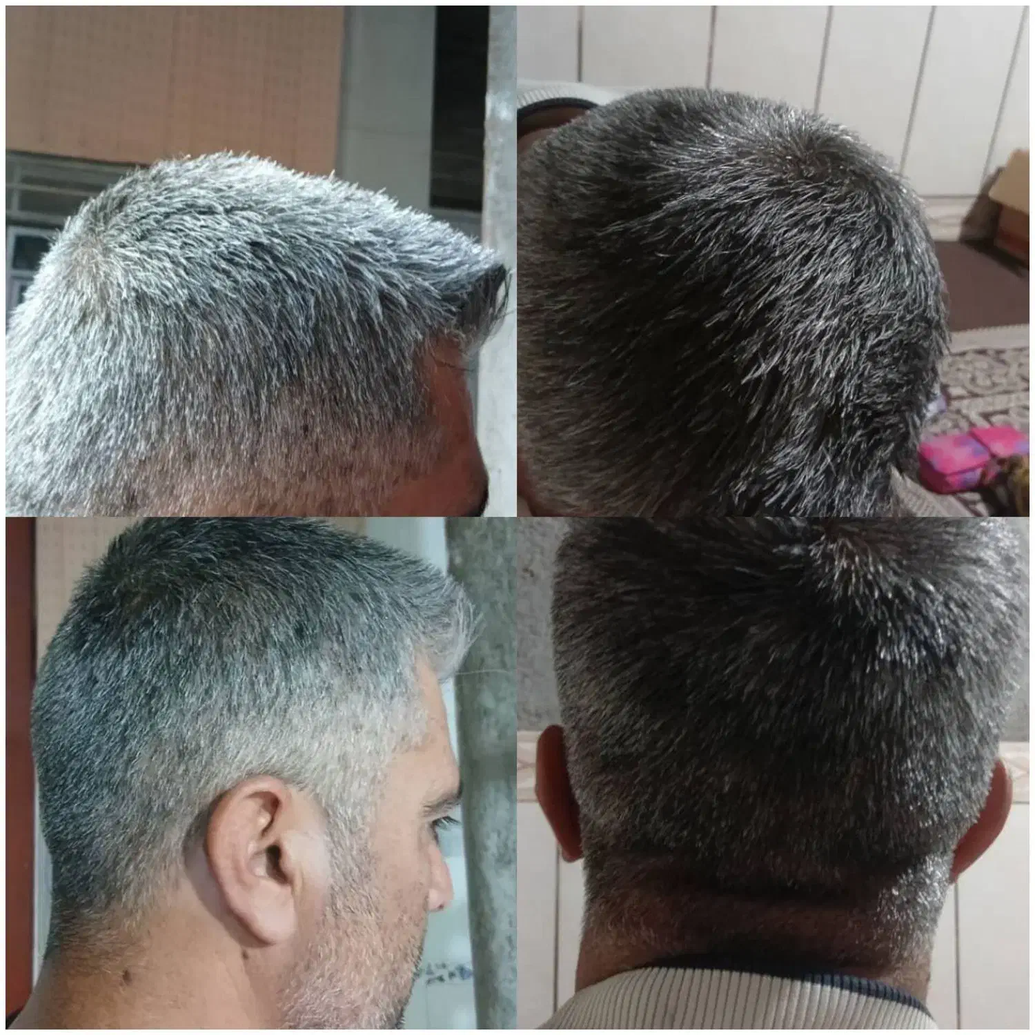 رفع سفیدی وریزش موی سر|فعالیت داوطلبانه|گوهرکوه, |دیوار