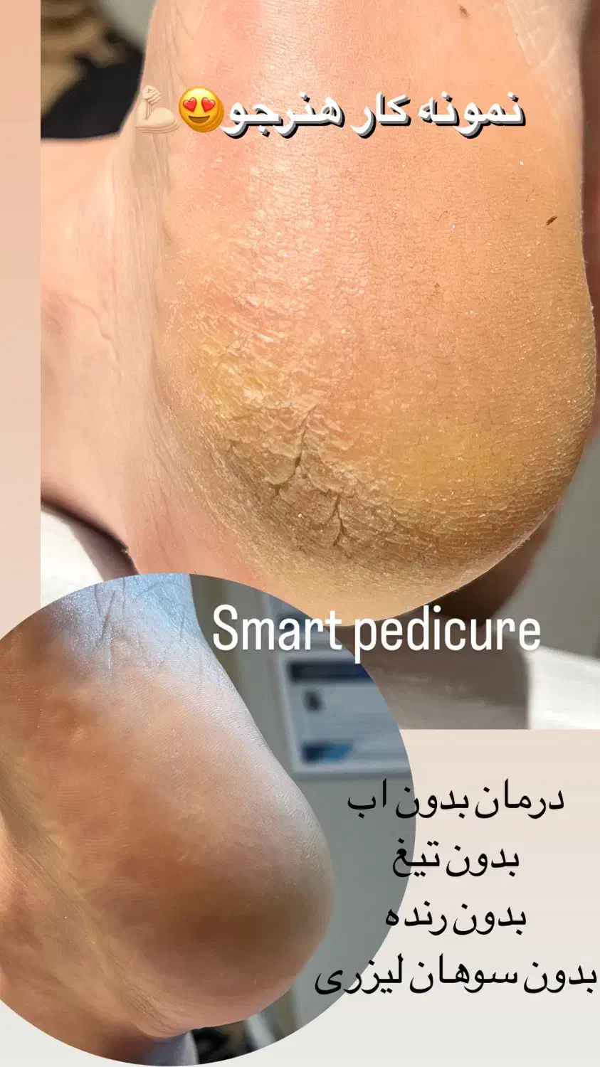 اموزش تخصصی پدیکور اسمارت مجازی و حضوری|خدمات آموزشی|یزد, |دیوار