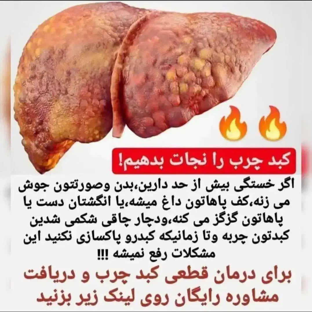 پاکسازی و کنترل کبد چرب|خدمات آرایشگری و زیبایی|خمینیشهر, |دیوار