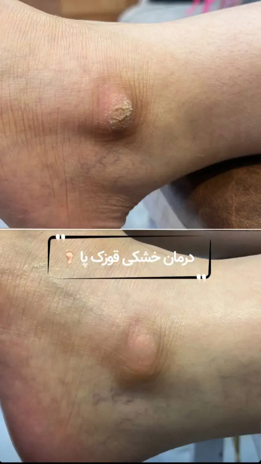 خدمات ناخن و کفسابی پا|خدمات آرایشگری و زیبایی|اصفهان, جلالیه|دیوار