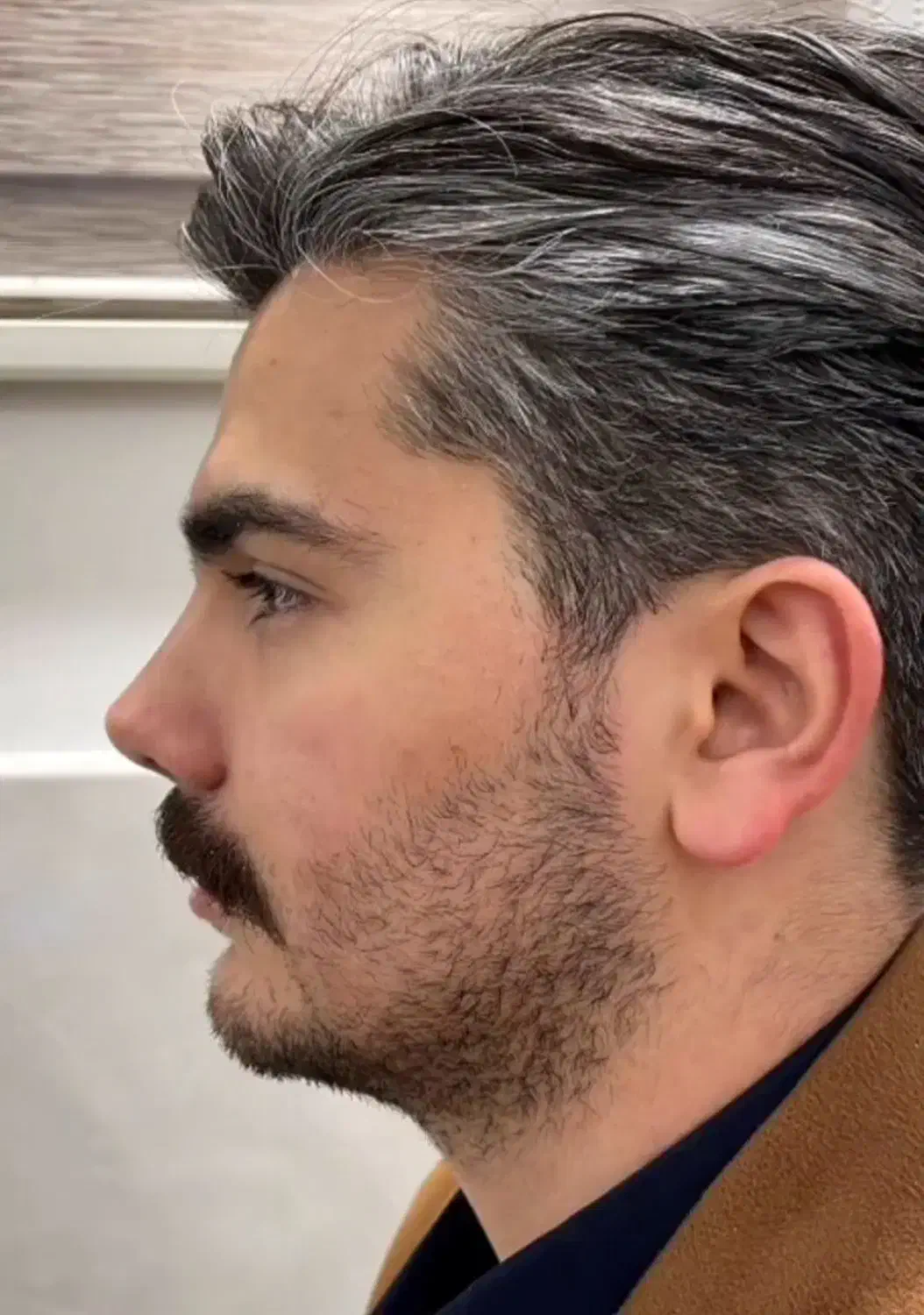 جراحی و عمل بینی توسط متخصص|خدمات آرایشگری و زیبایی|چهارباغ, |دیوار