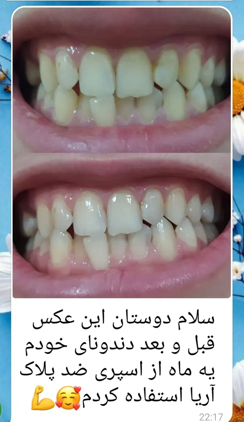 اسپری گیاهی درمانی|آرایشی، بهداشتی، درمانی|خوسف, |دیوار