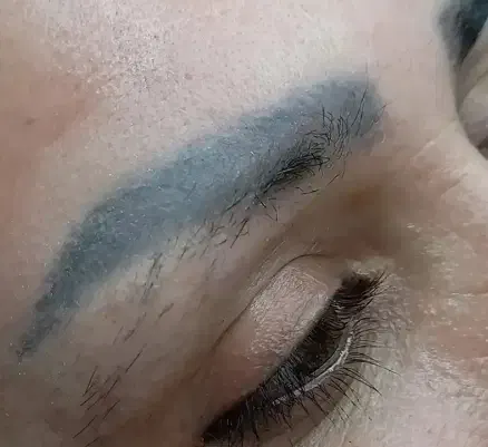 پاک کردن تتو با قیمت استثنایی فقط بانوان|خدمات آرایشگری و زیبایی|مشهد, نیروی هوایی|دیوار