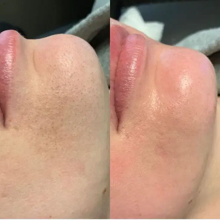 50% تخفیف خدمات تخصصی پوست و مو ۲۹۸|خدمات آرایشگری و زیبایی|مشهد, آزادشهر|دیوار