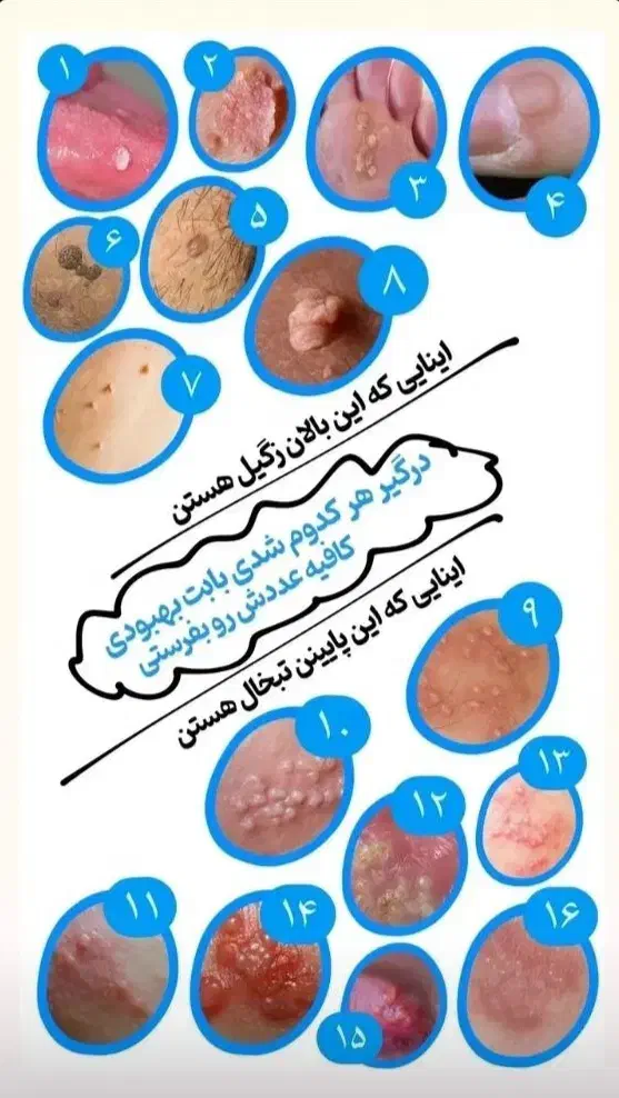 درد رو تموم کن برای خودت|خدمات آرایشگری و زیبایی|فیروزآباد, |دیوار