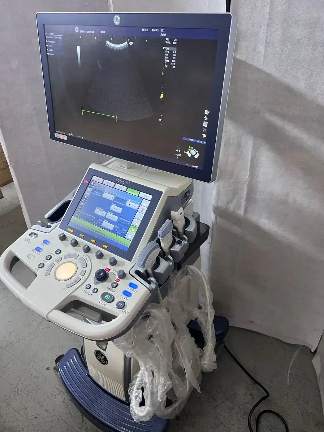 سونوگرافی هندهلد جی ایی GE|آرایشی، بهداشتی، درمانی|تهران, تهران‌ویلا|دیوار
