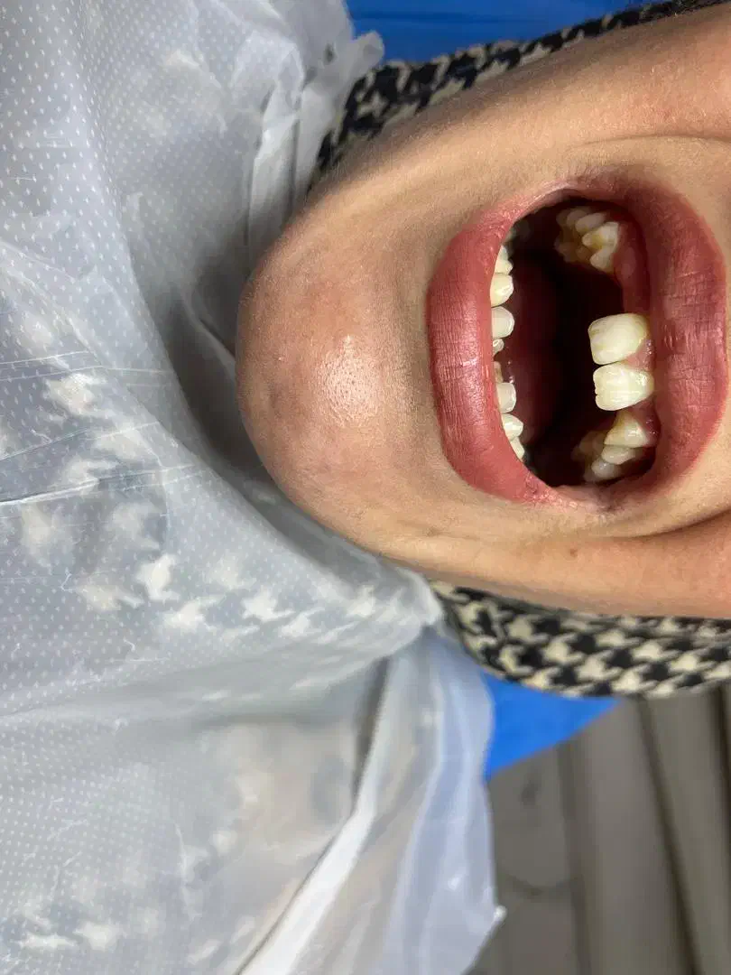 آموزش تخصصی کامپوزیت دندان با برد تخصصی|خدمات آموزشی|اندیشه, شهرک کوثر|دیوار