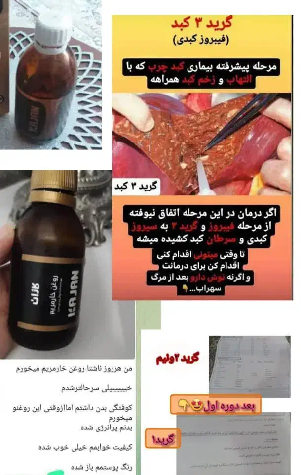 دمنوش و روغن مختص کبدچرب|خوردنی و آشامیدنی|امیرآباد, |دیوار