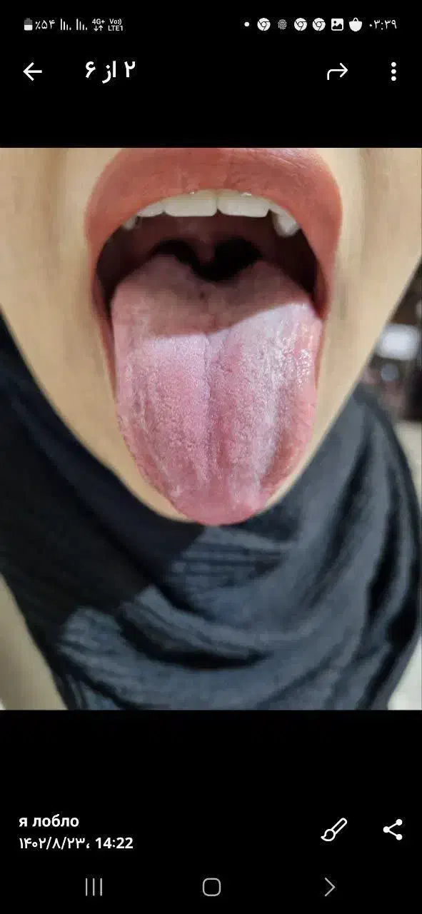 سونوگرافی از روی زبان|خدمات آرایشگری و زیبایی|قم, محمد آباد|دیوار