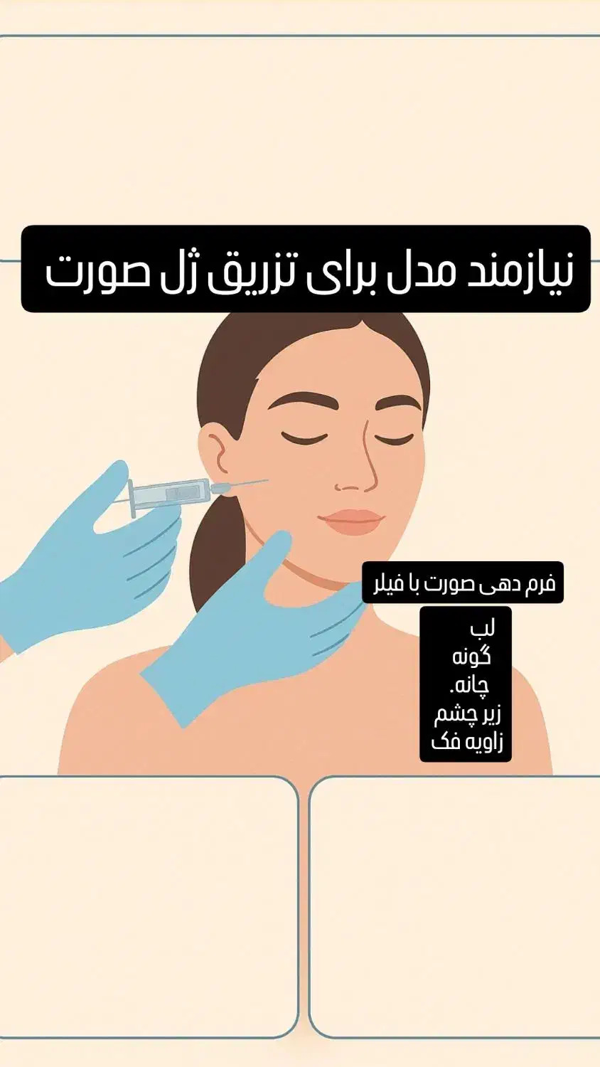نیازمندمدل فیلر صورت(زیرچشم لب چانه گونه زاویه فک)|خدمات آرایشگری و زیبایی|شیراز, قصرالدشت|دیوار