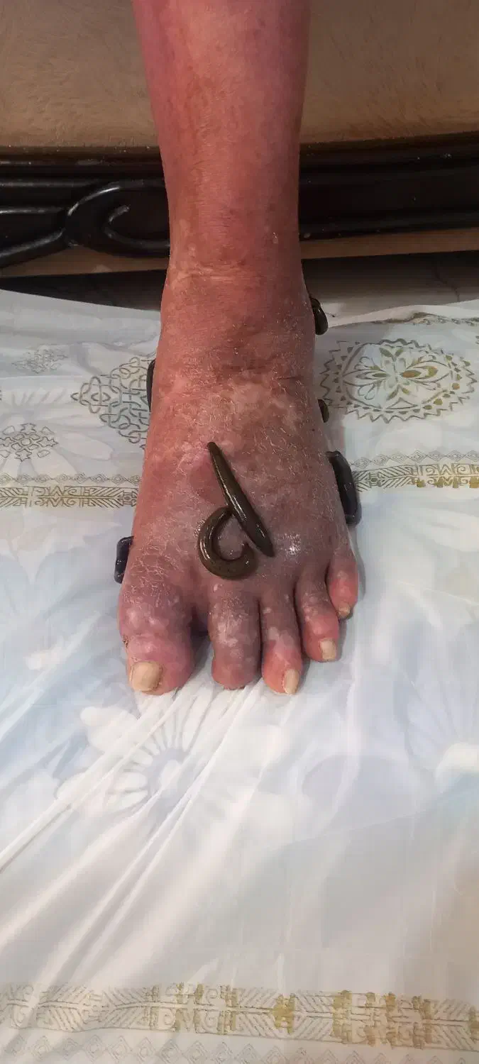 سمزدایی وحجامت|خدمات آرایشگری و زیبایی|کرج, گلشهر|دیوار