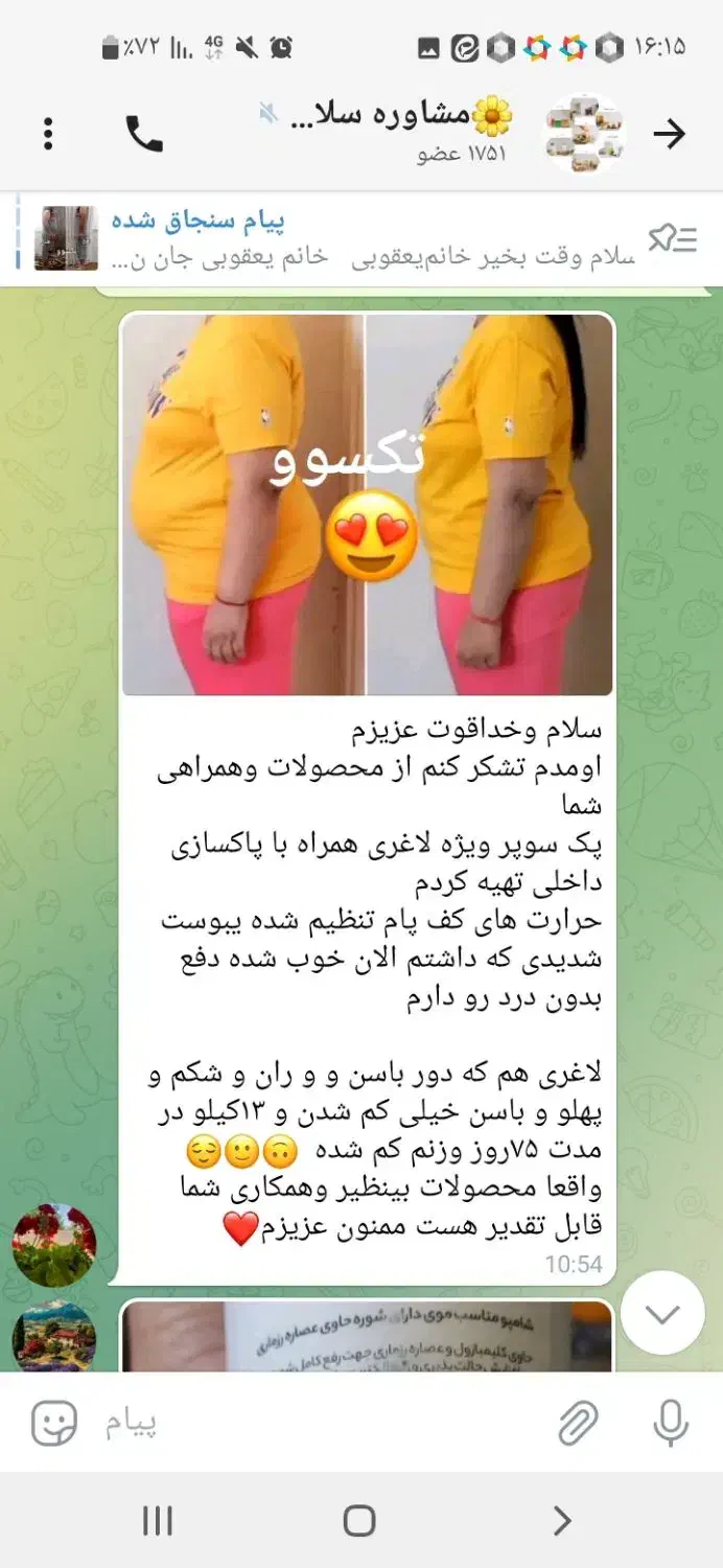 چربیسوزی با تکسوو|آرایشی، بهداشتی، درمانی|قزوین, |دیوار