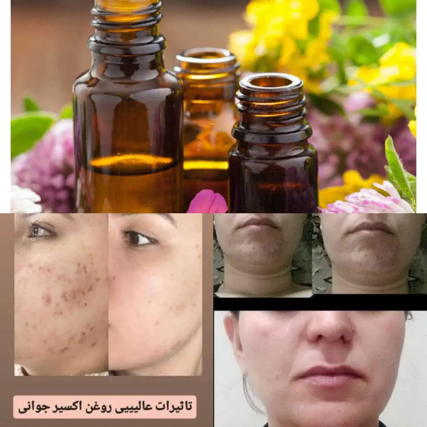 فراخوان روغن تراپی|خدمات آموزشی|تبریز, |دیوار