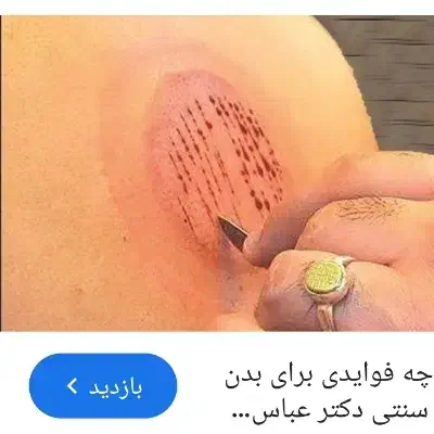 حجامت بادکش|خدمات آرایشگری و زیبایی|کاشان, میدان کهنه|دیوار