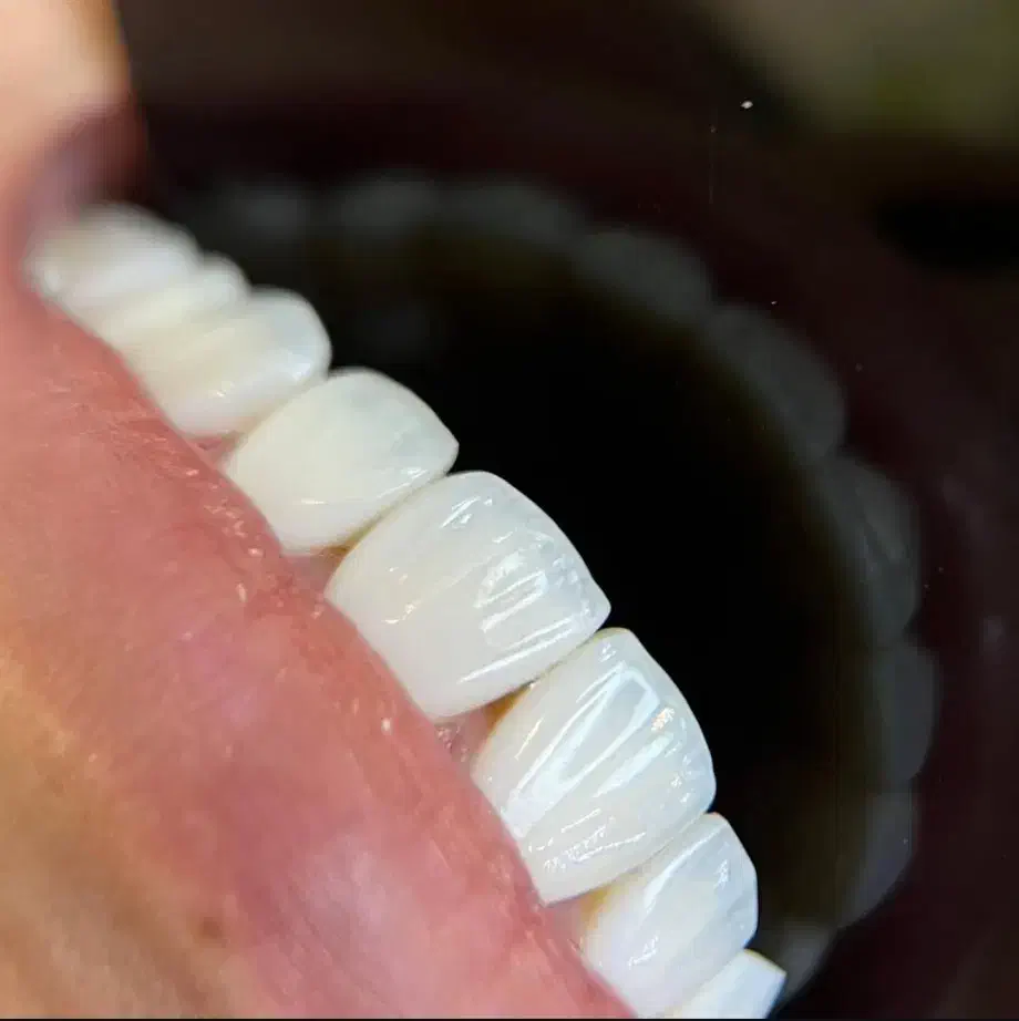 جشنواره خدمات دندانپزشکی با اقساط ۱۵ ماهه + وام|خدمات آرایشگری و زیبایی|تبریز, |دیوار