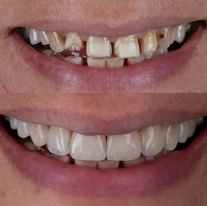 دندانپزشکی مجهز به بی حسی بدون درد دیجیتالی+اقساط|خدمات آرایشگری و زیبایی|خرم‌آباد, |دیوار