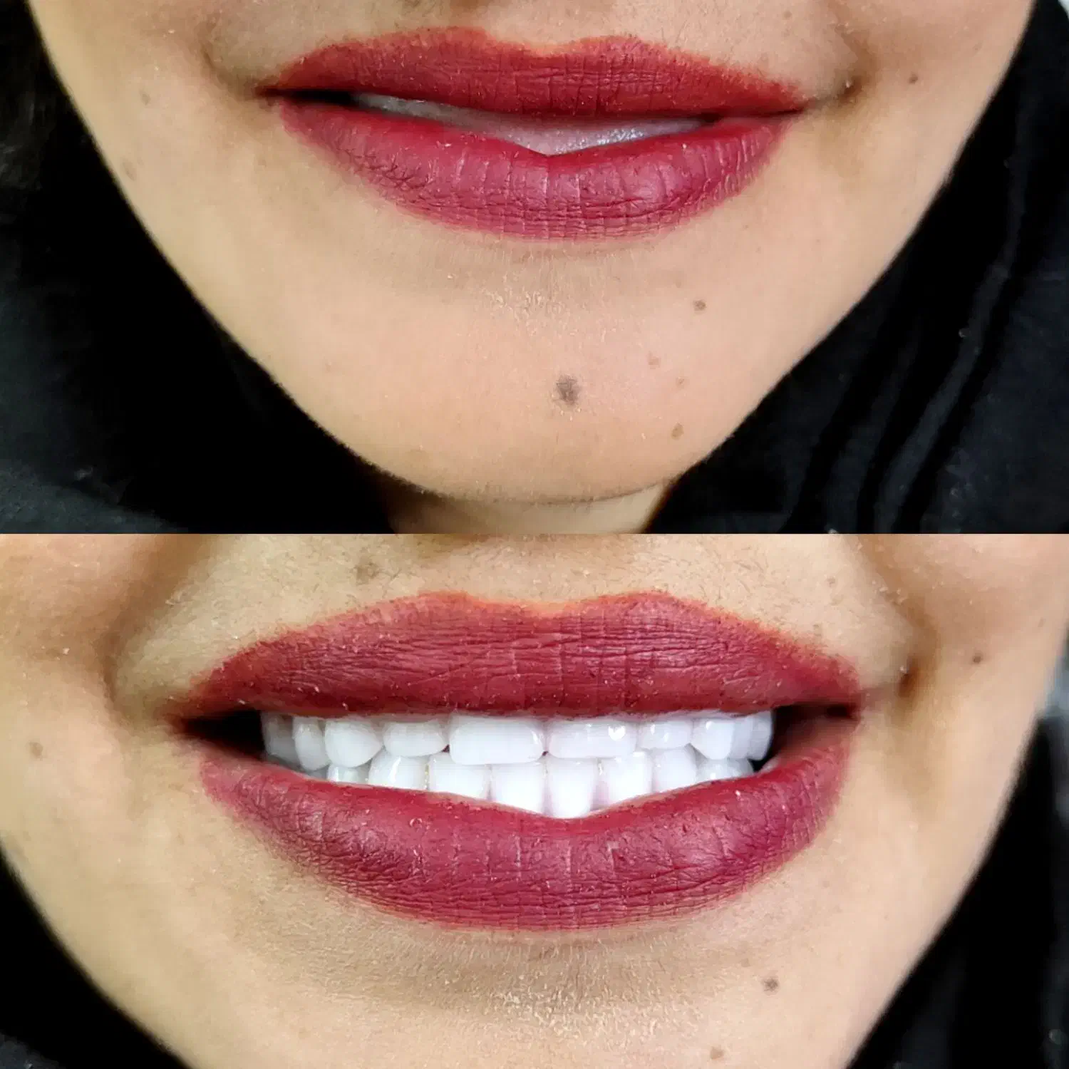 دندان ،دندان سازی ،دندان مصنوعی ،جوان پسند،اقساطی|خدمات آرایشگری و زیبایی|مشهد, شاهد (شهرک غرب)|دیوار