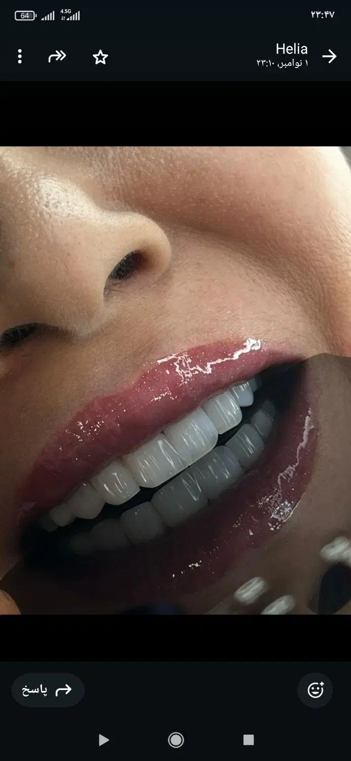 قیمت کامپوزیت فقط8میلیون با ضمانت ده ساله (تهران)|خدمات آرایشگری و زیبایی|رشت, جماران|دیوار