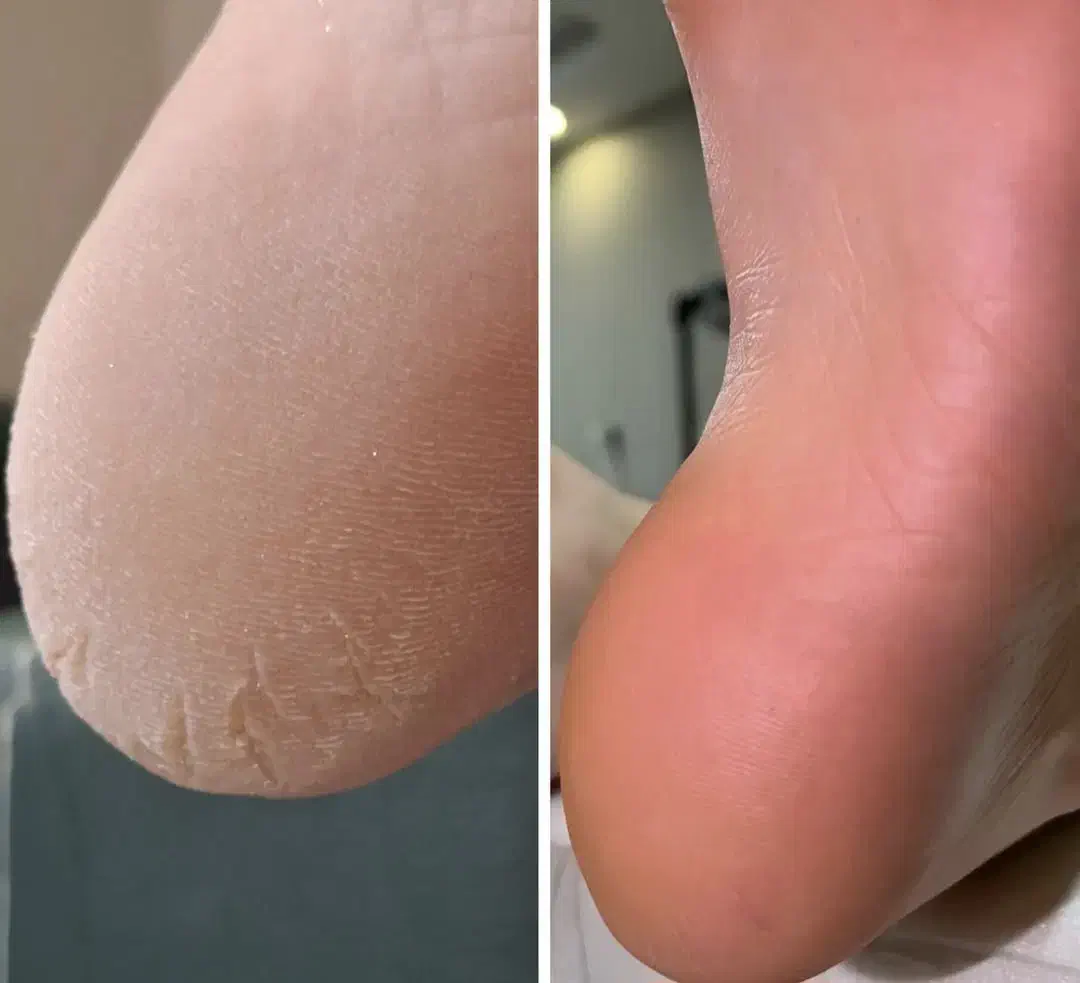 پدیکور با قیمتی مناسب|خدمات آرایشگری و زیبایی|رشت, معلم|دیوار