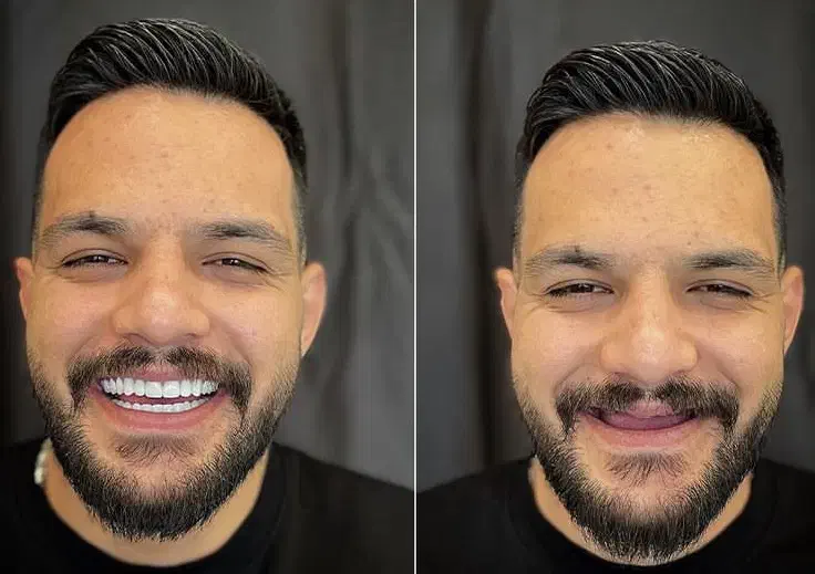 دندانسازی مصنوعی دندان مصنوعی با کیفیت و زیبا|خدمات آرایشگری و زیبایی|تبریز, |دیوار