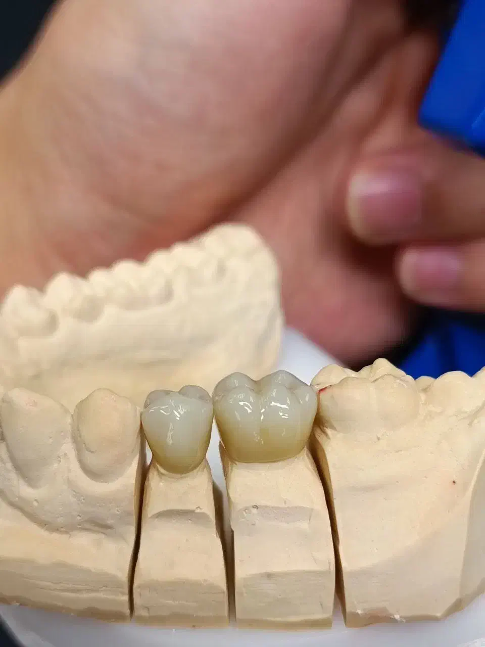 لابراتوار پروتز دندانی ادیب|آرایشی، بهداشتی، درمانی|گلبهار, شهر جدید گلبهار|دیوار