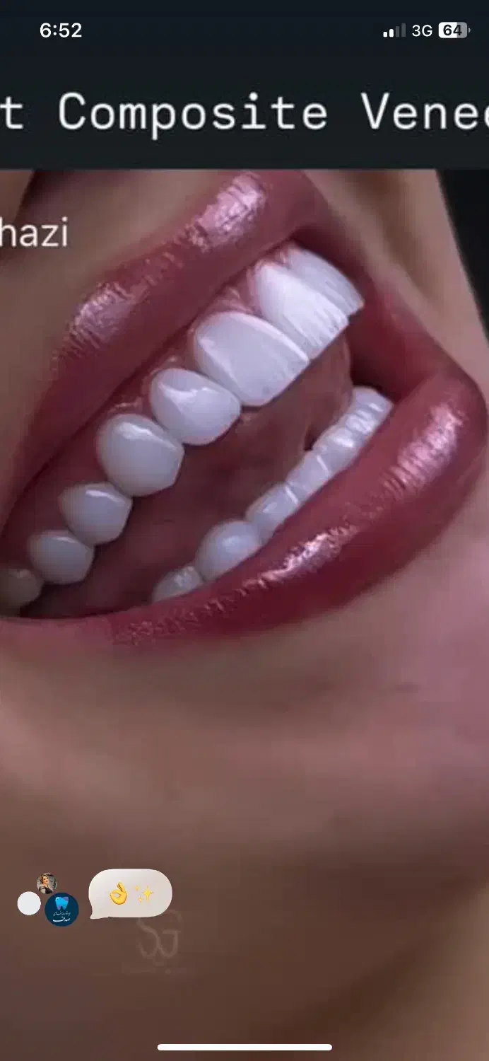 دستیار دندانپزشک|استخدام درمانی، زیبایی، بهداشتی|کرج, جهان‌شهر|دیوار