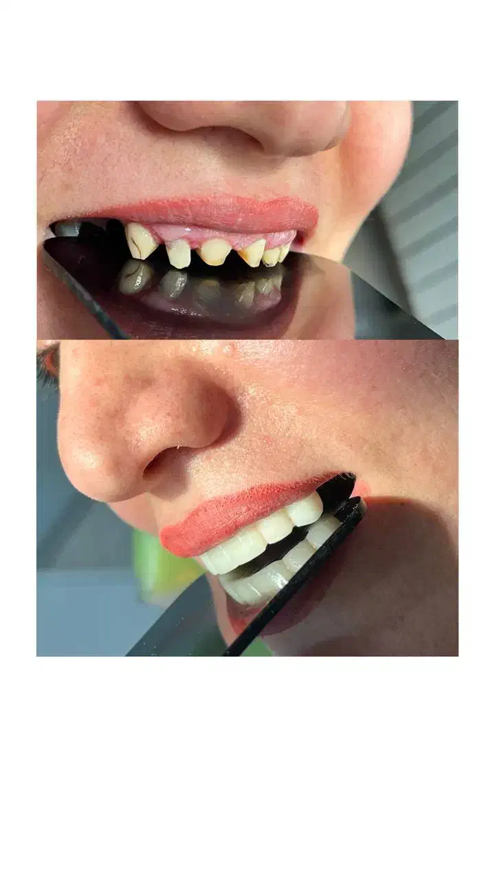 جشنواره دندانپزشکی درمانی و زیبایی|خدمات آرایشگری و زیبایی|تهران, هفت حوض|دیوار