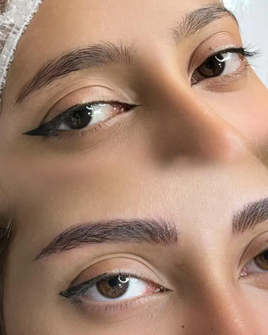 انجام تخصصی فیبروز و میکروبلیدینگ +آموزش+مدرک|خدمات آرایشگری و زیبایی|اهواز, گلستان|دیوار