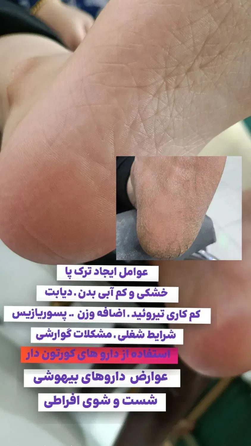 ارائه کلیه خدمات آرایشی و زیبایی|خدمات آرایشگری و زیبایی|گنبد کاووس, |دیوار