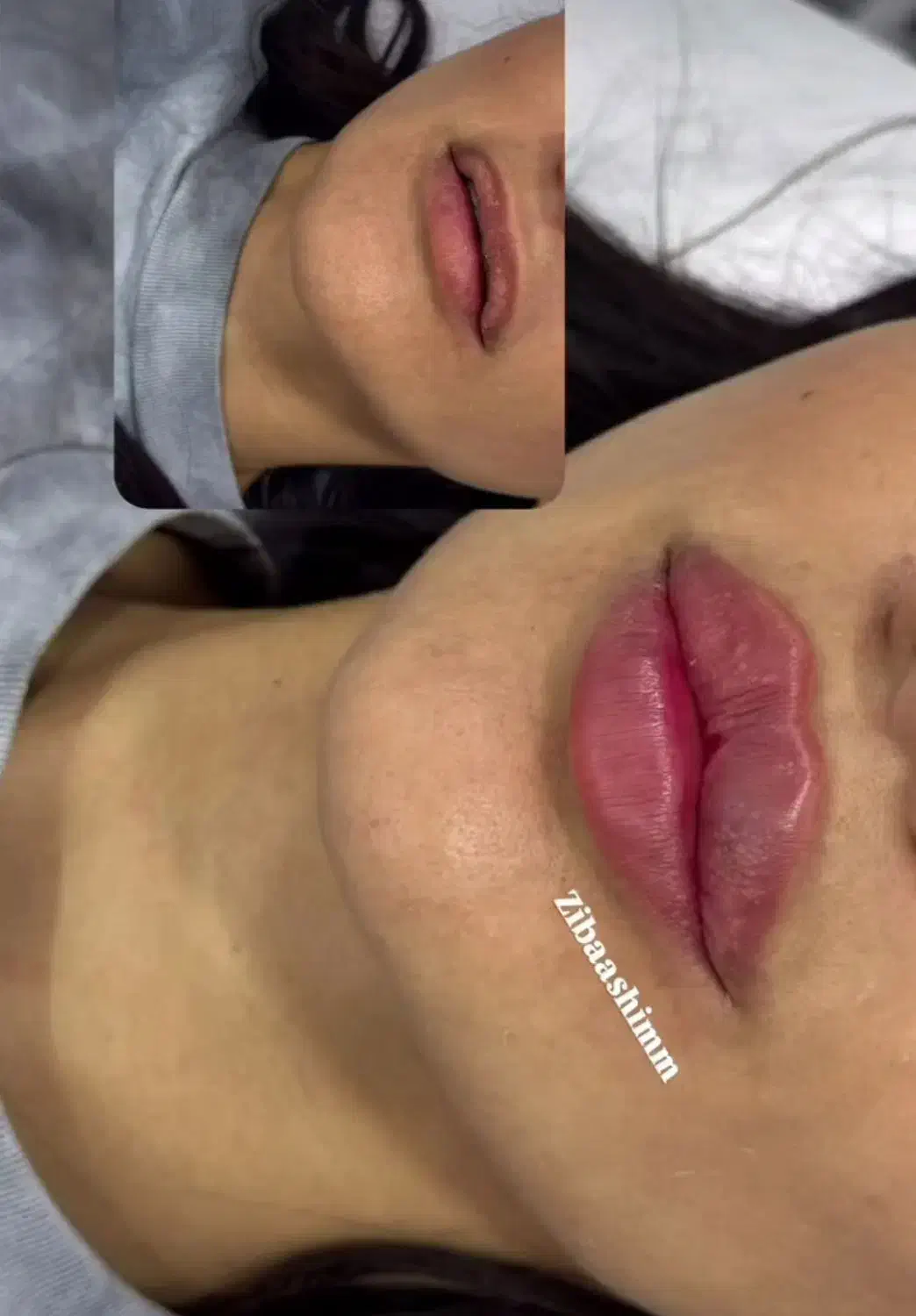 خدمات زیبایی هر سی سی فیلر ۸۵۰|خدمات آرایشگری و زیبایی|اصفهان, تیران|دیوار