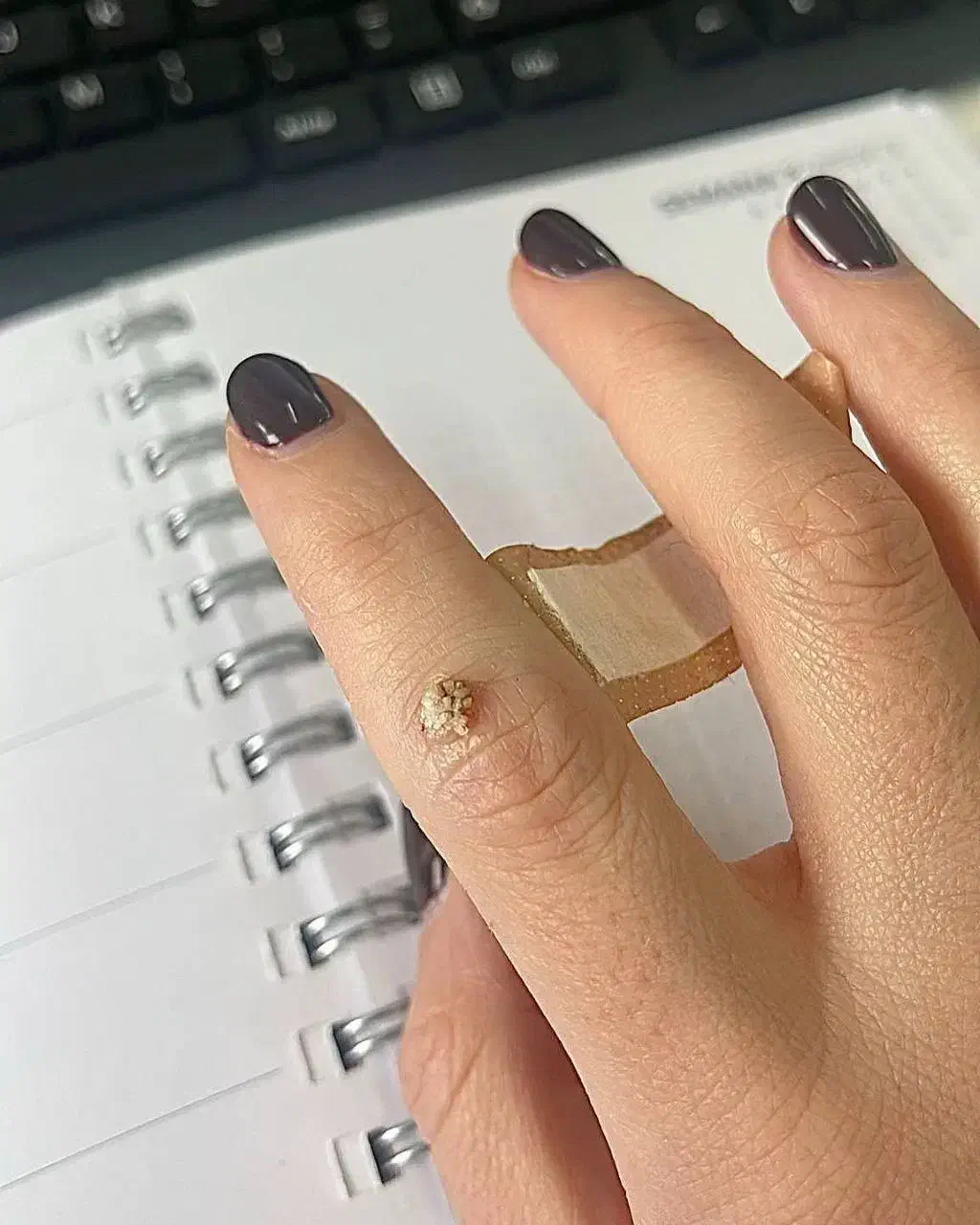 بهبودی ززگیل و تبخاال تظمینی|آرایشی، بهداشتی، درمانی|آبادان, |دیوار