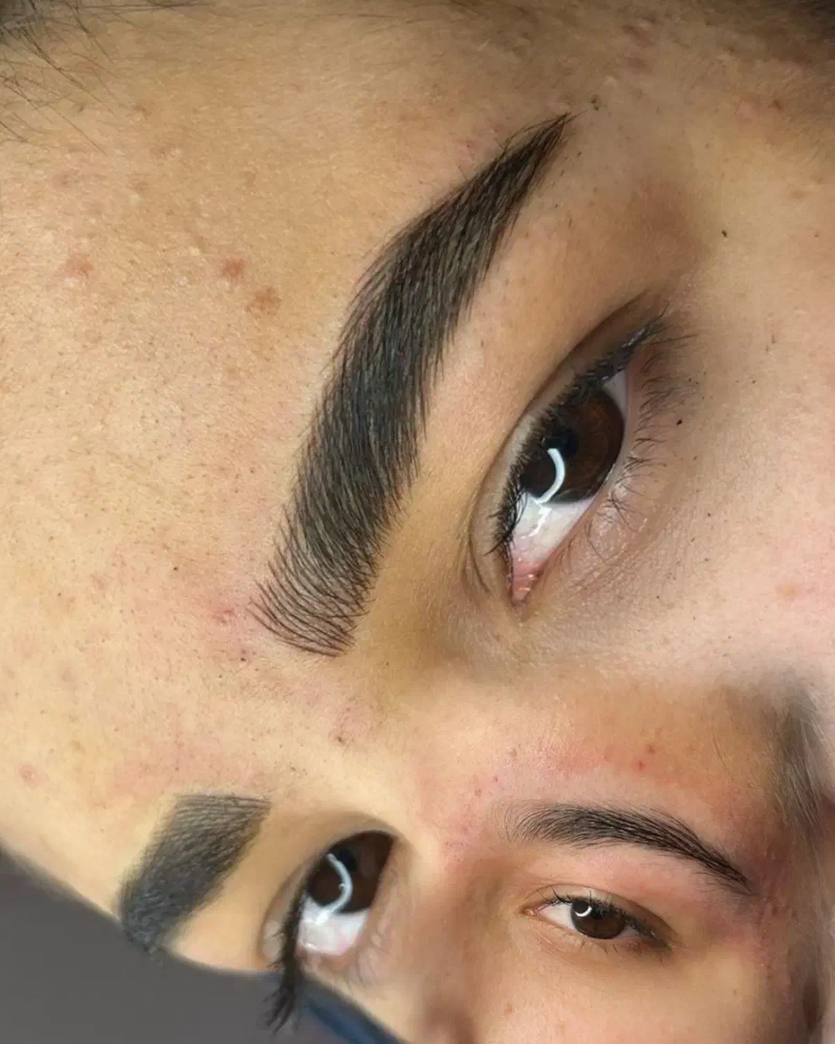 تخفیف ویژه میکرووژل بوتاکس|خدمات آرایشگری و زیبایی|بیرجند, |دیوار