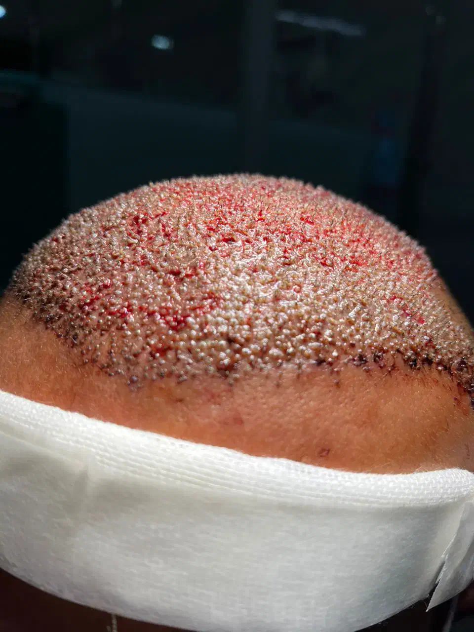 جذب و استخدام کاشت مو|استخدام آموزشی|شیراز, ستارخان|دیوار