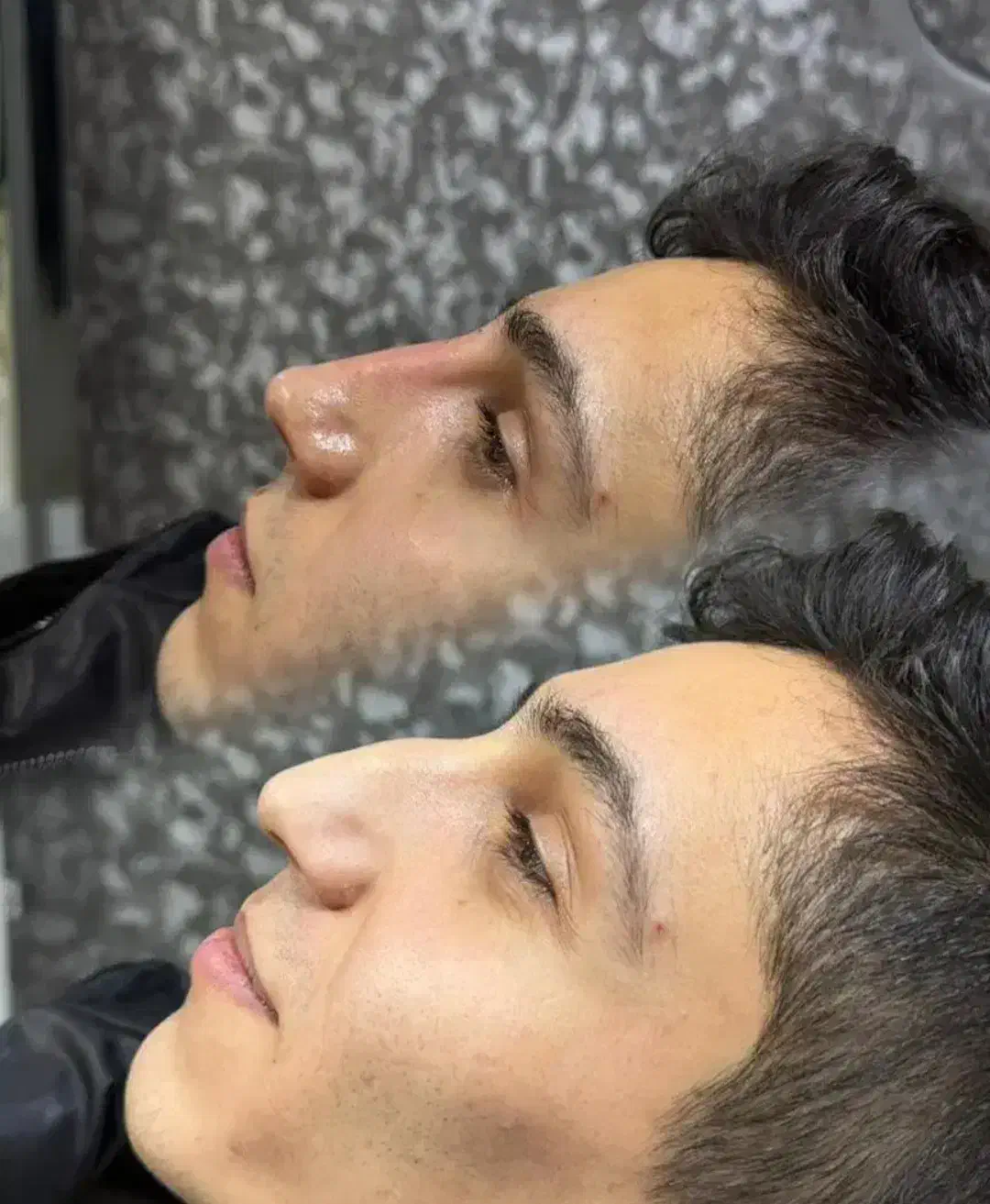 ژل بوتاکس 550|خدمات آرایشگری و زیبایی|پرند, فاز ۵|دیوار