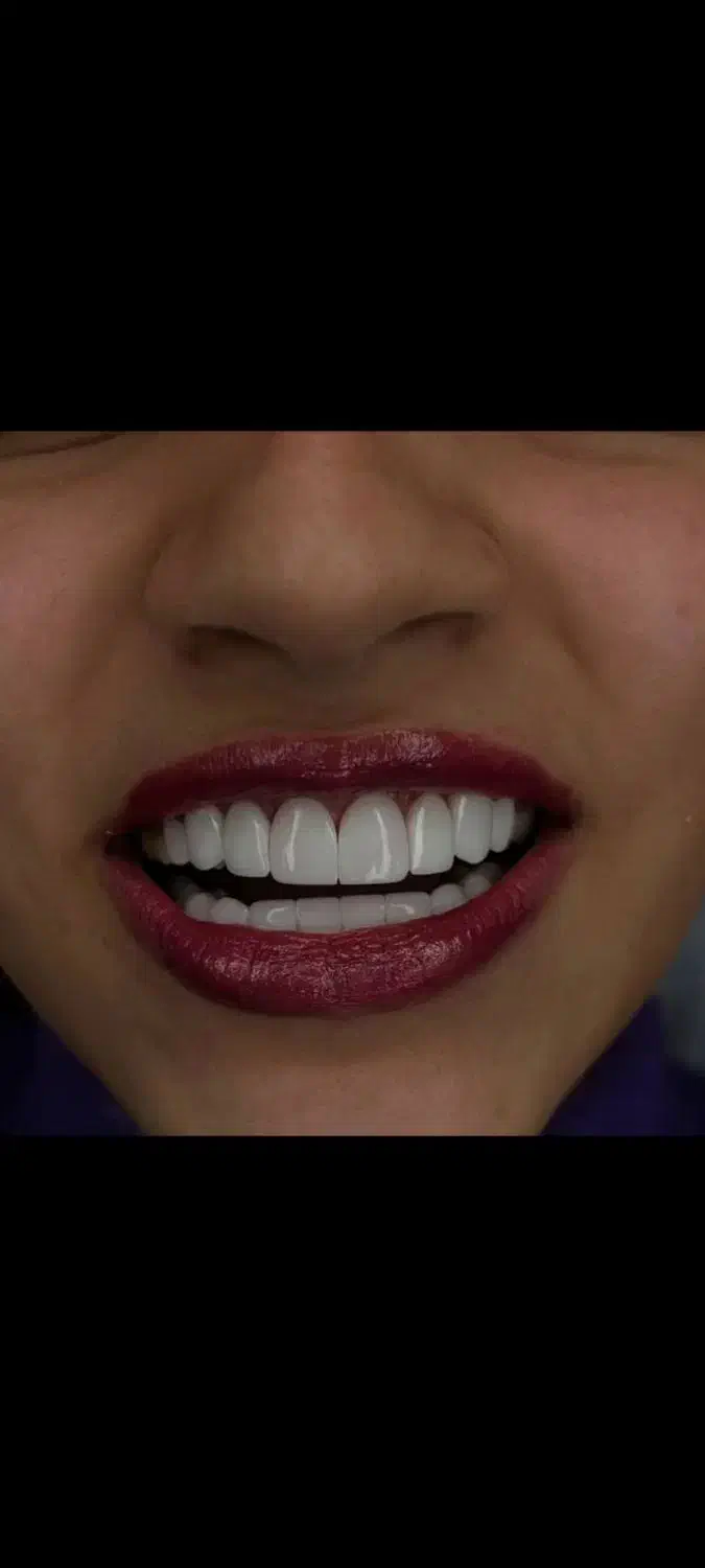 آموزش تخصصی دندانسازی و بلیچینگ و کامپوزیت|خدمات آموزشی|شیراز, معالیآباد|دیوار